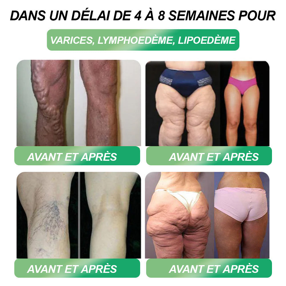 (HHVB®) ❤️ Plus que 6 boîtes ! Bénéficiez de -30 % aujourd’hui ! GLP-1 solution orale aide à contrôler poids et glycémie avec des résultats durables en 4-6 boîtes. Ne tardez plus, agissez vite !