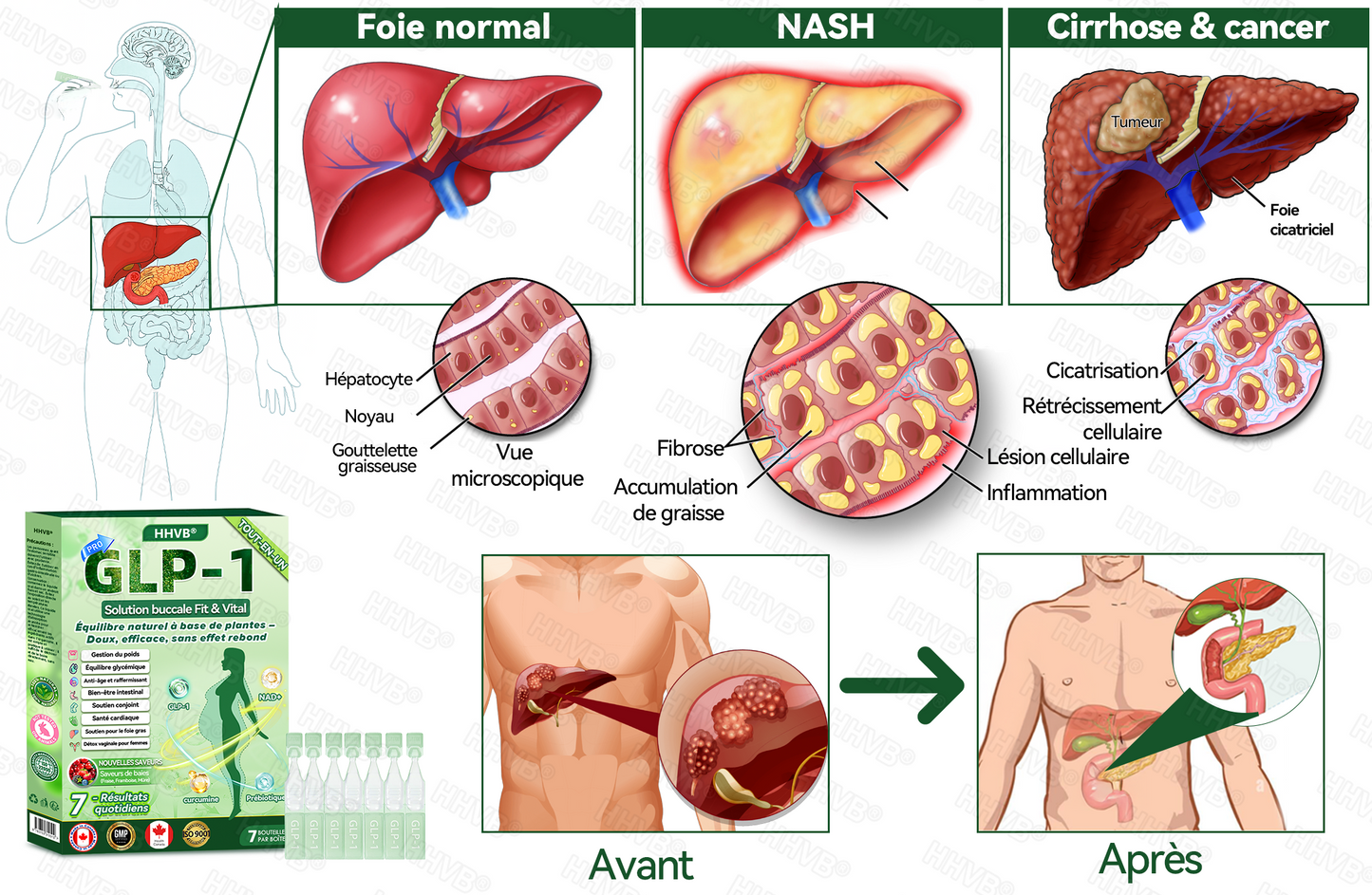 🇨🇦 Magasin Officiel | 𝐇𝐇𝐕𝐁® 🍀𝑁𝐴𝐷+ 𝐺𝐿𝑃-1 𝙎𝙤𝙡𝙪𝙩𝙞𝙤𝙣 𝙤𝙧𝙖𝙡𝙚 𝙩𝙤𝙪𝙩-𝙚𝙣-𝙪𝙣 𝙁𝙞𝙩&𝙑𝙞𝙩𝙖𝙡 – 1x/jour, résultats visibles en 7 jours ✅ Soutien pour obésité, cœur, diabète, sommeil, digestion et articulations